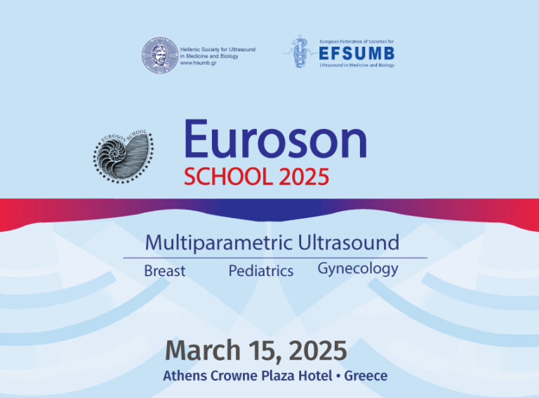 EUROSON-2025-1200x630 (1)